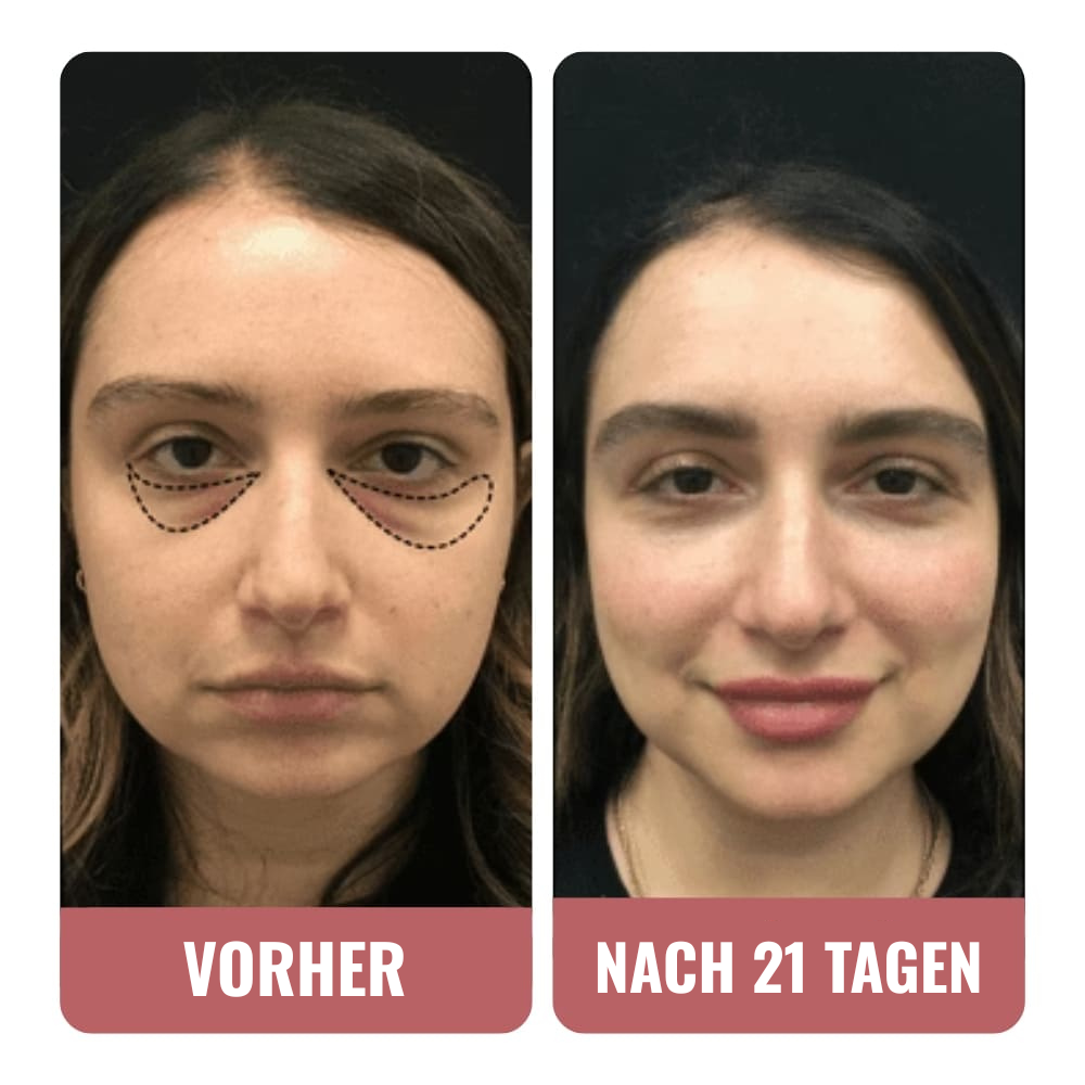 Ich habe viele Concealer ausprobiert.