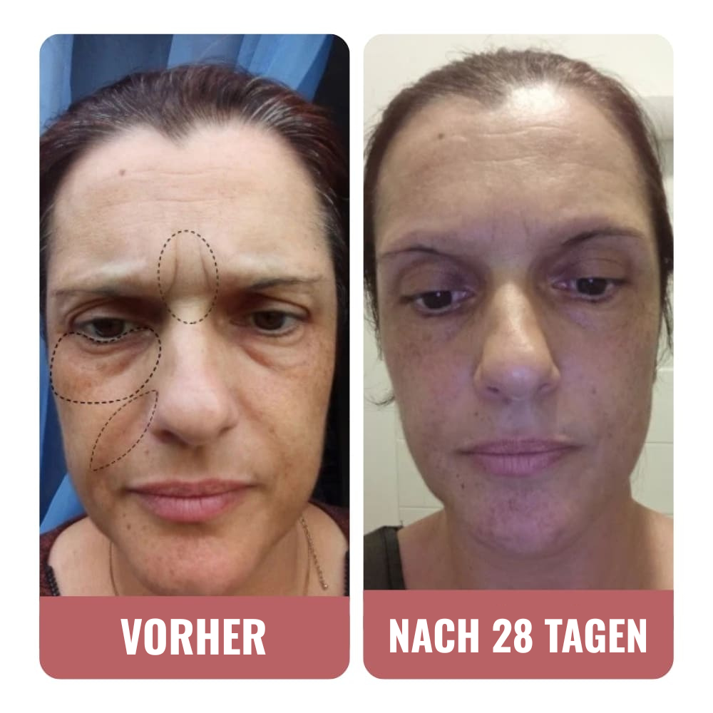 Diese Wombea-Creme ist beeindruckend.