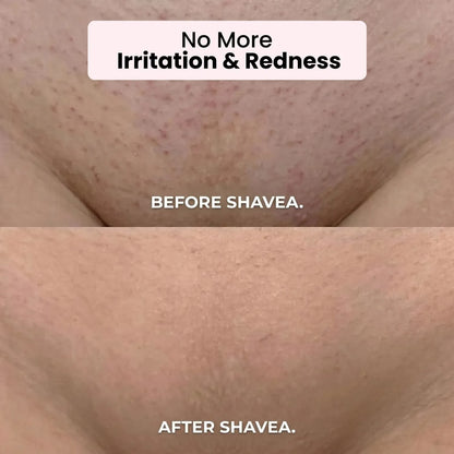 Shavea™ 2‑in‑1 Bikini & Body Trimmer