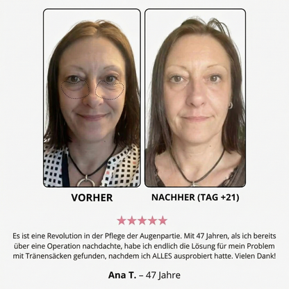 Creme mit rotem Licht für die Augenpartie