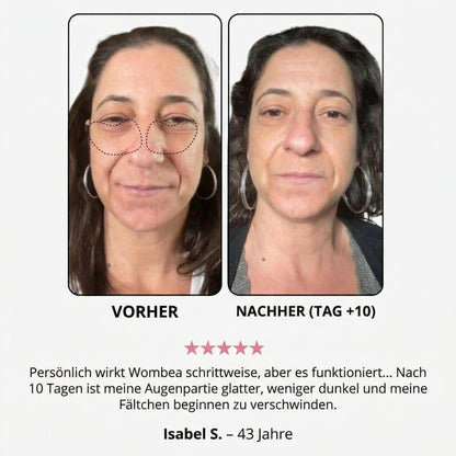 Creme mit rotem Licht für die Augenpartie