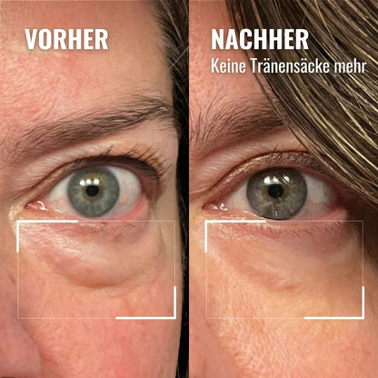 Creme mit rotem Licht für die Augenpartie